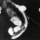 Image for article titled These are the world's most devastating maritime disasters